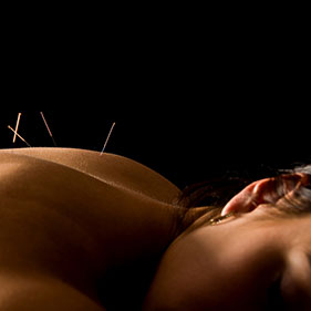 Cosmetic Acupuncture, Sea of Qi Barossa Valley